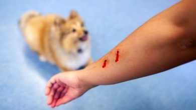 does a dog have to be put down if it bites someone